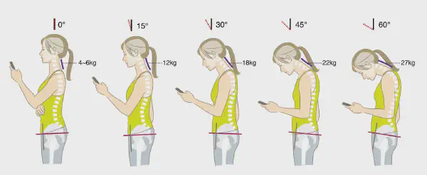 Unmasking the Hidden Link: How Dental Issues Exacerbate Tech Neck