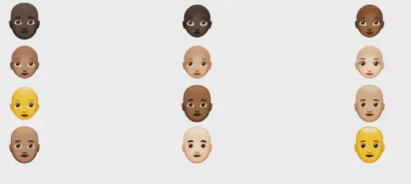 MyHair AI Leverages Visual Analysis to Diagnose Hair Loss and Suggest Treatments